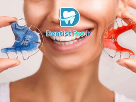 اصلاح لبخند بدون ارتودنسی+ 5 روش موثر