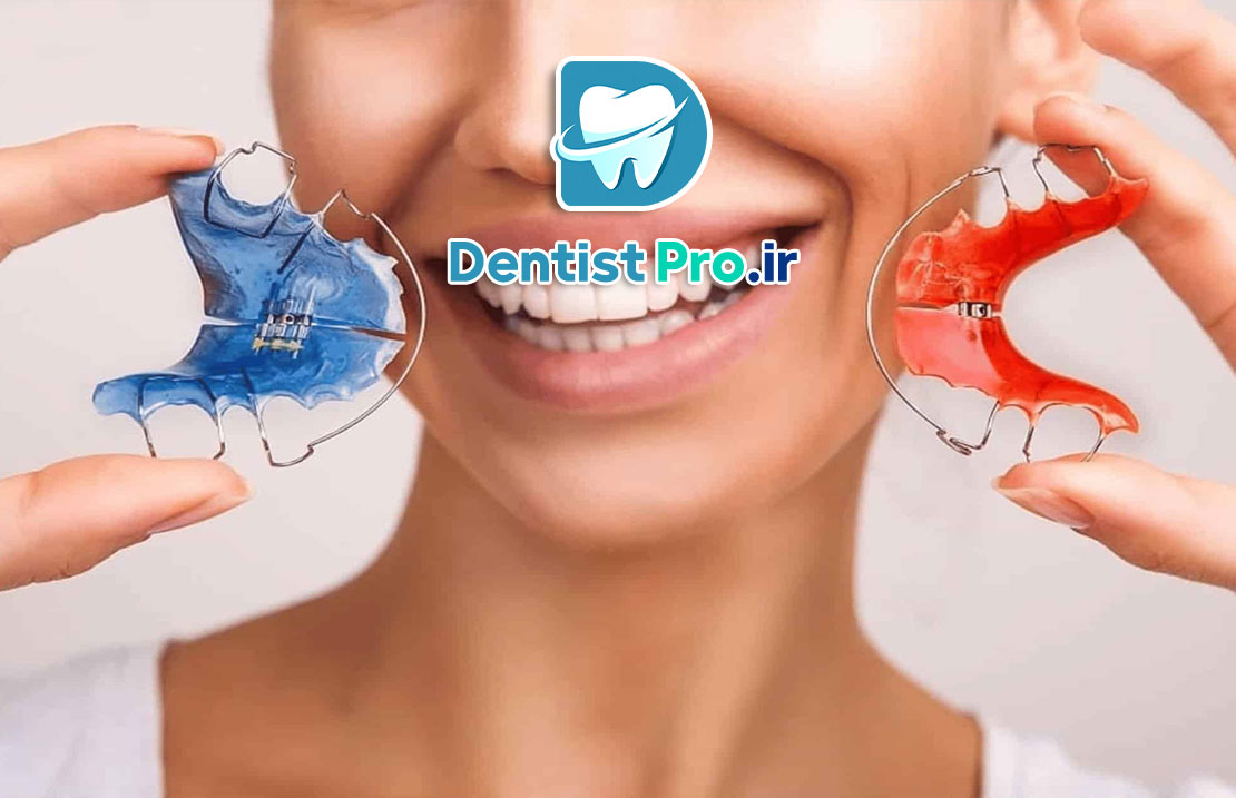 اصلاح لبخند بدون ارتودنسی+ 5 روش موثر 25 اصلاح لبخند بدون ارتودنسی+ 5 روش موثر