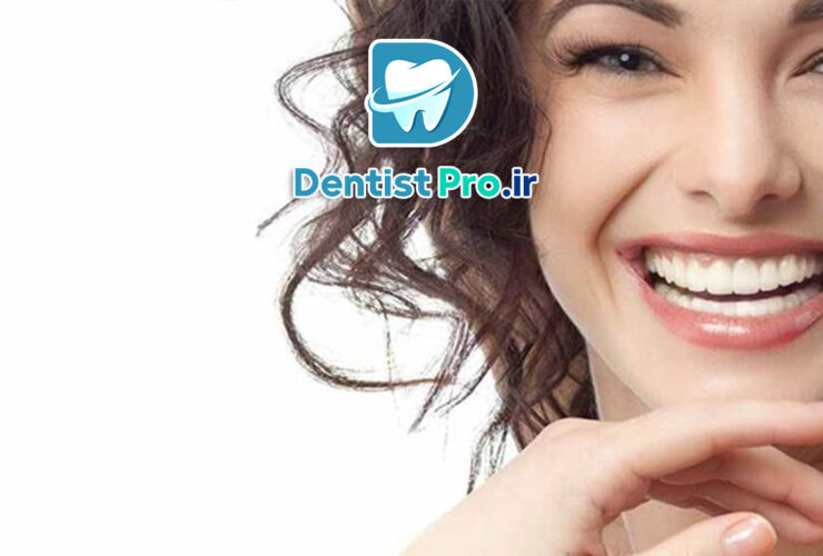 لبخند مثل بازیگرها+ راهکارهای طلایی آن چیست؟ 48 لبخند مثل بازیگرها+ راهکارهای طلایی آن چیست؟