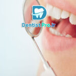 بهترین نوع پرکردگی برای دندان پوسیده چیست؟