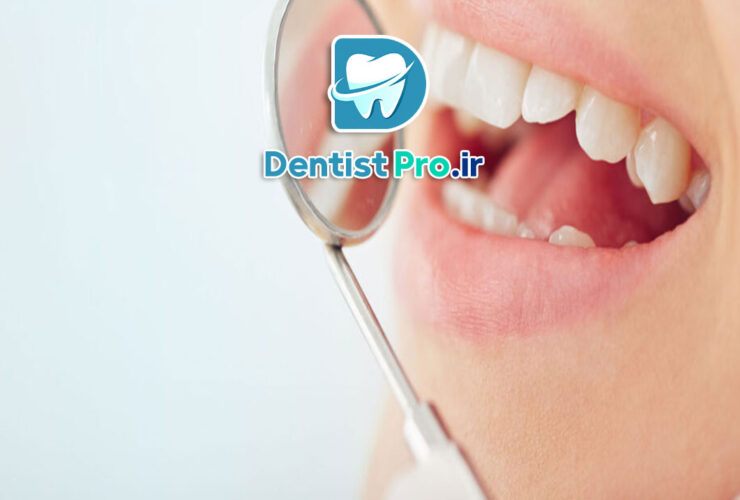 بهترین نوع پرکردگی برای دندان پوسیده چیست؟