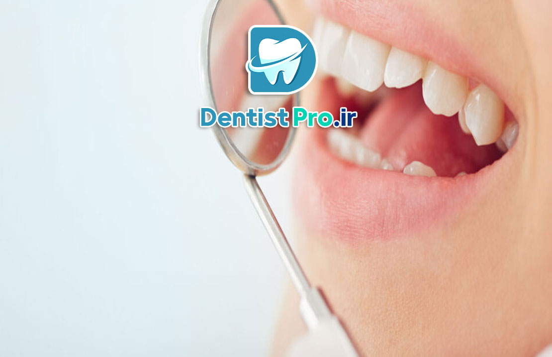 بهترین نوع پرکردگی برای دندان پوسیده چیست؟