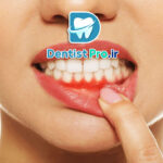 خطرناک بودن دندان عفونی: تهدیدی پنهان برای سلامت شما از نگاه یک دندانپزشک متخصص