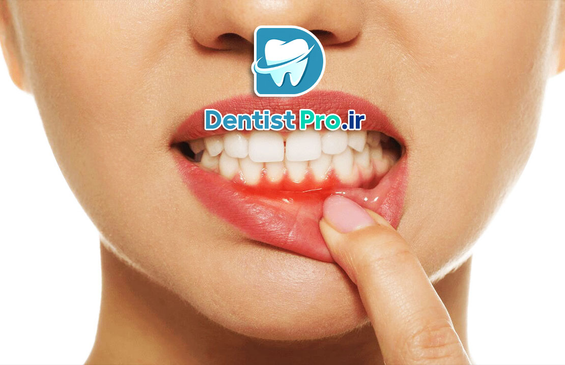 خطرناک بودن دندان عفونی: تهدیدی پنهان برای سلامت شما از نگاه یک دندانپزشک متخصص