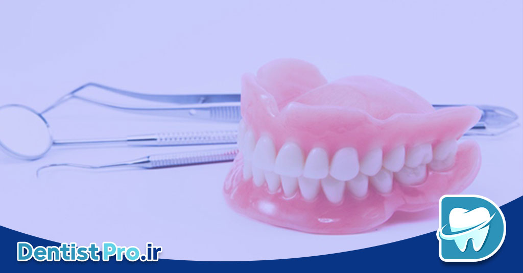 تفاوت ایمپلنت و بریج+بررسی 3 بعد مهم