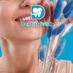 جدیدترین روش های زیبایی دندان+ 7 روش که نمی دانید