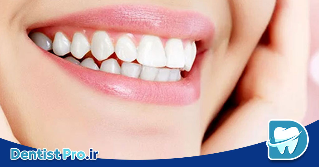 جدیدترین روش های زیبایی دندان+ 7 روش که نمی دانید