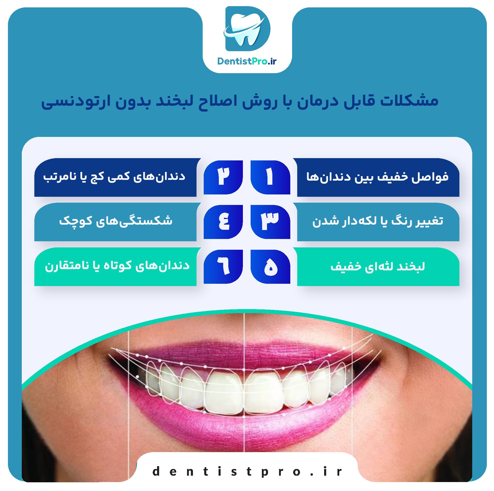 اصلاح لبخند بدون ارتودنسی+ 5 روش موثر 27 اصلاح لبخند بدون ارتودنسی+ 5 روش موثر