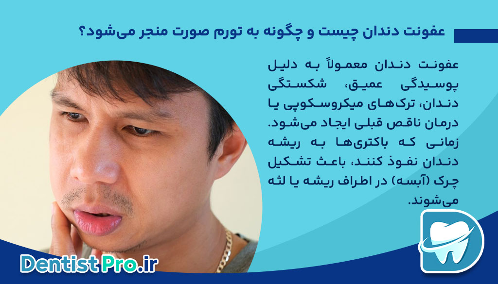 اگر صورت‌تان ناگهان ورم کرد، مراقب باشید! تورم صورت به خاطر عفونت دندان را جدی بگیرید