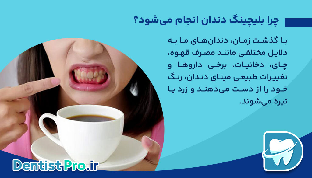 بلیچینگ دندان بدون درد