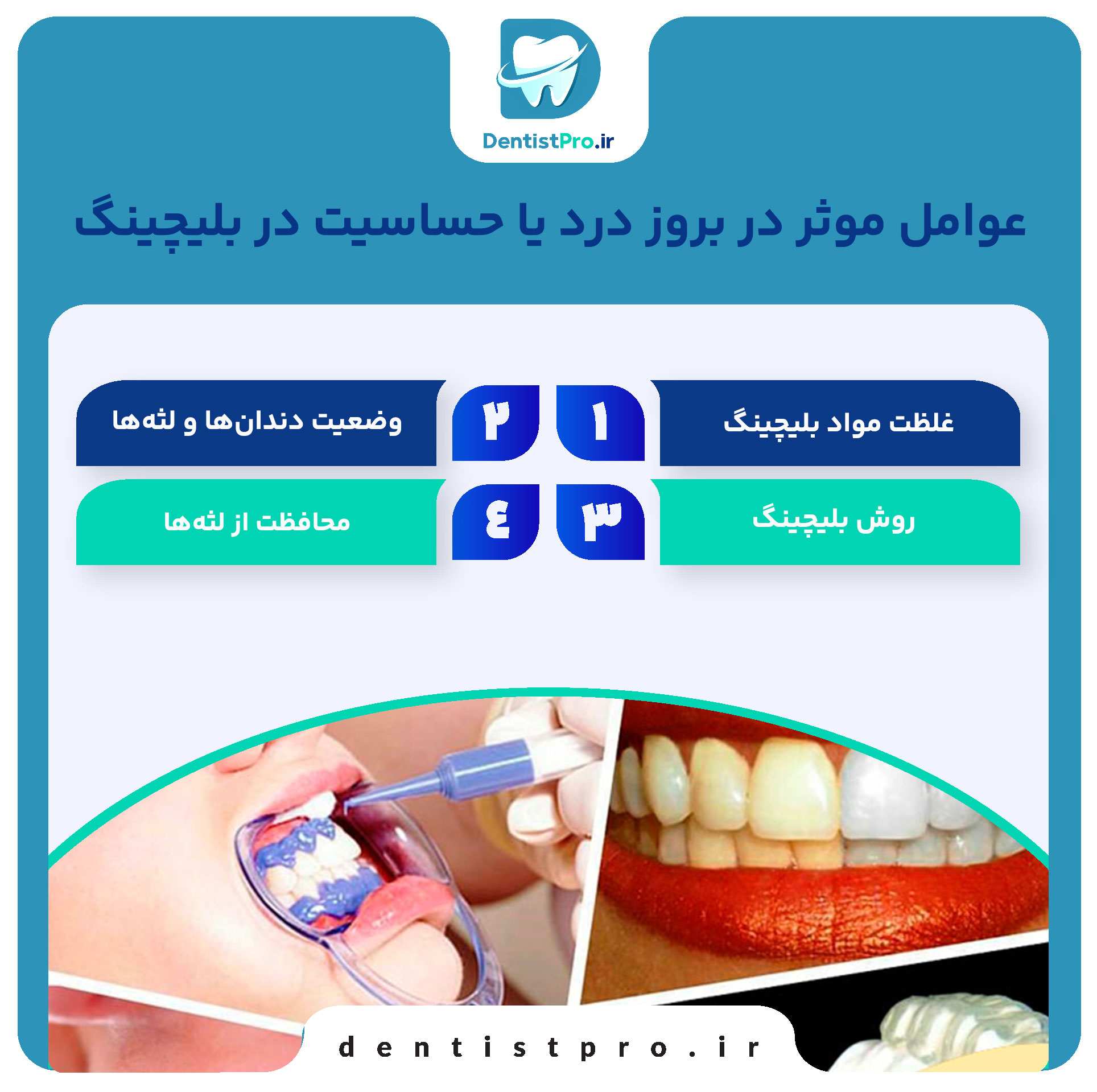 بلیچینگ دندان بدون درد