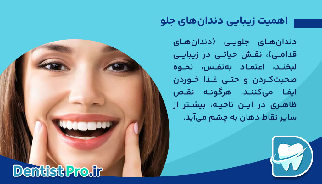 بهترین نوع لمینت برای دندان جلو از نگاه یک دندانپزشک متخصص