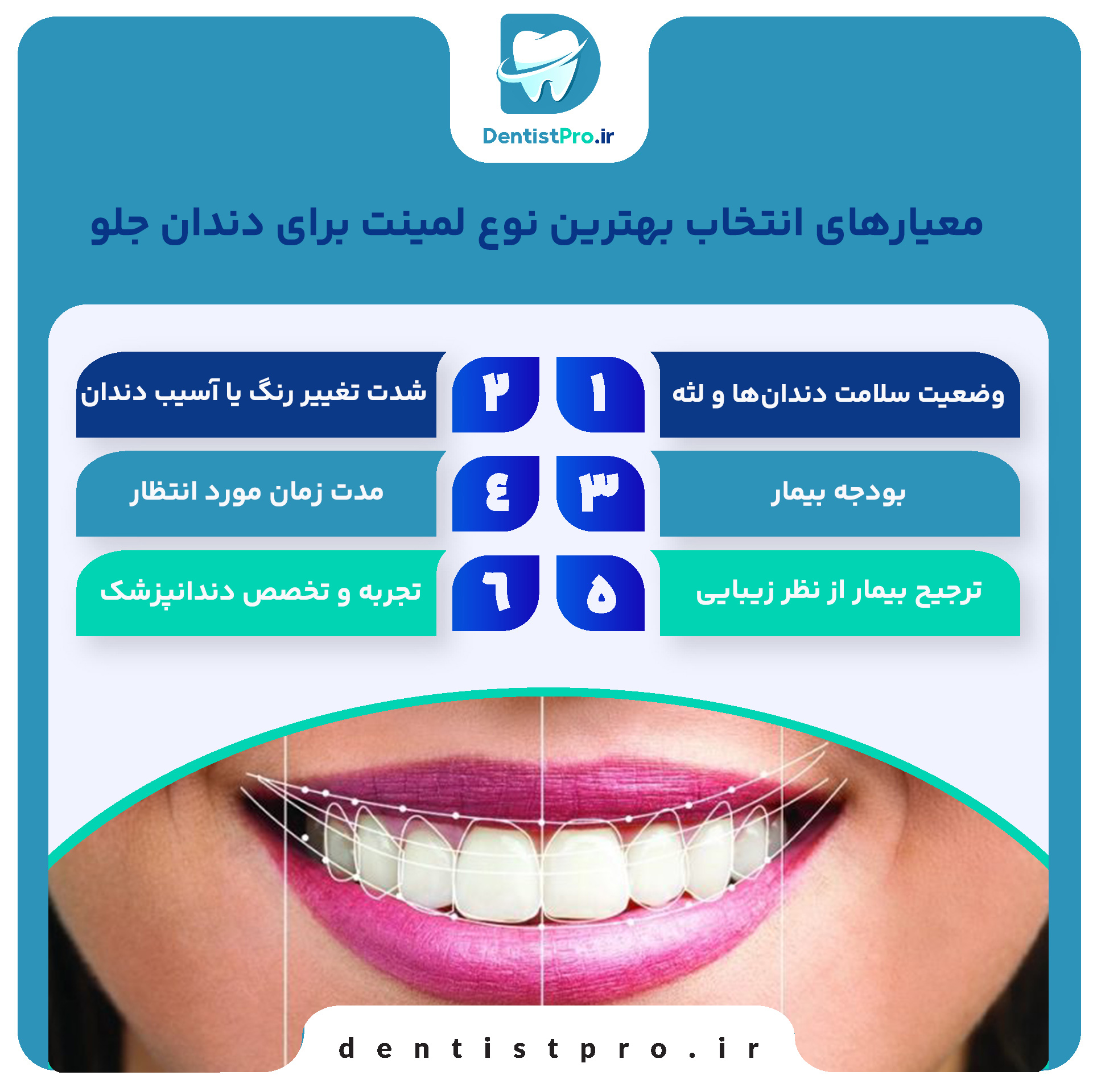 بهترین نوع لمینت برای دندان جلو از نگاه یک دندانپزشک متخصص