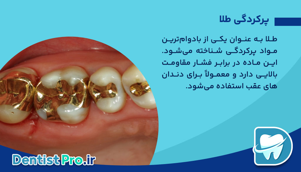 بهترین نوع پرکردگی برای دندان پوسیده چیست؟
