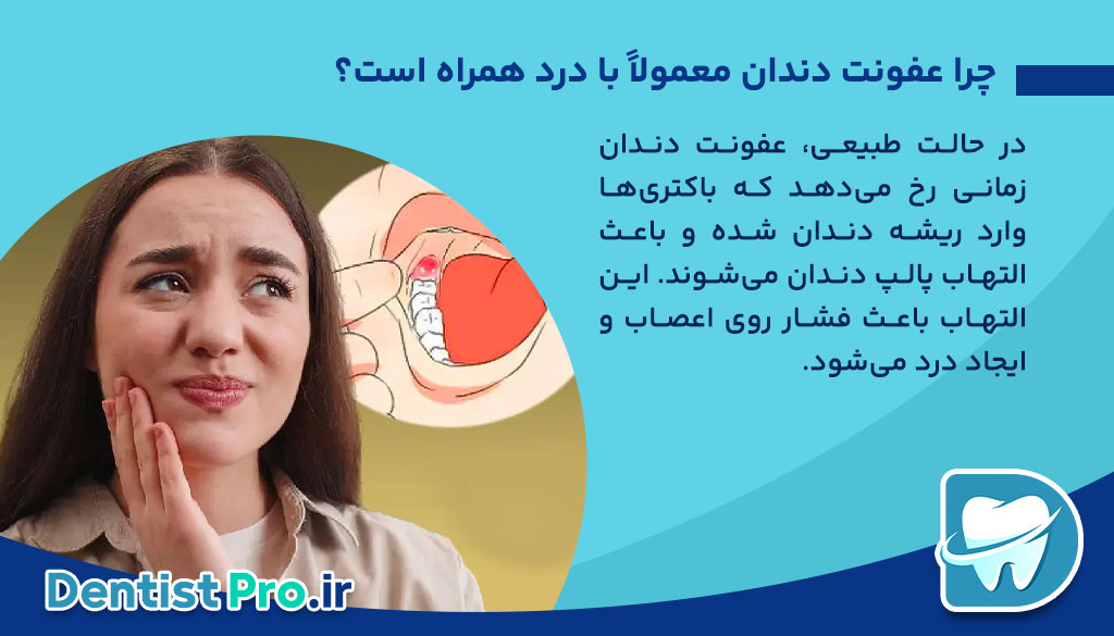 عفونت دندان بدون درد: تهدید خاموش سلامت دهان 26 عفونت دندان بدون درد: تهدید خاموش سلامت دهان