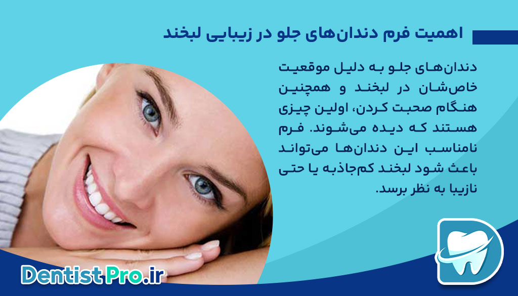 فرم دهی دندان های جلو؛ راهنمایی جامع از زبان یک متخصص دندانپزشک
