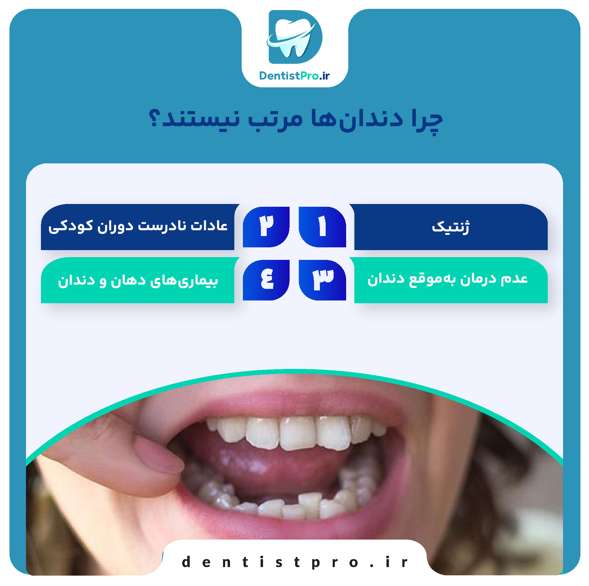 لبخند زیبا با دندان های مرتب+10 نکته کاربردی 27 لبخند زیبا با دندان های مرتب+10 نکته کاربردی
