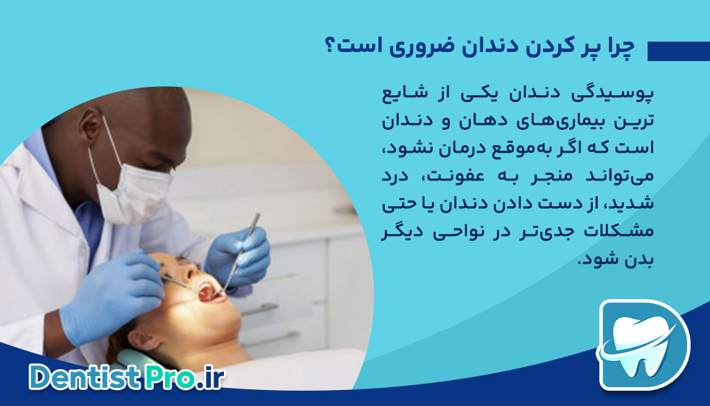 پر کردن دندان با مواد سفید