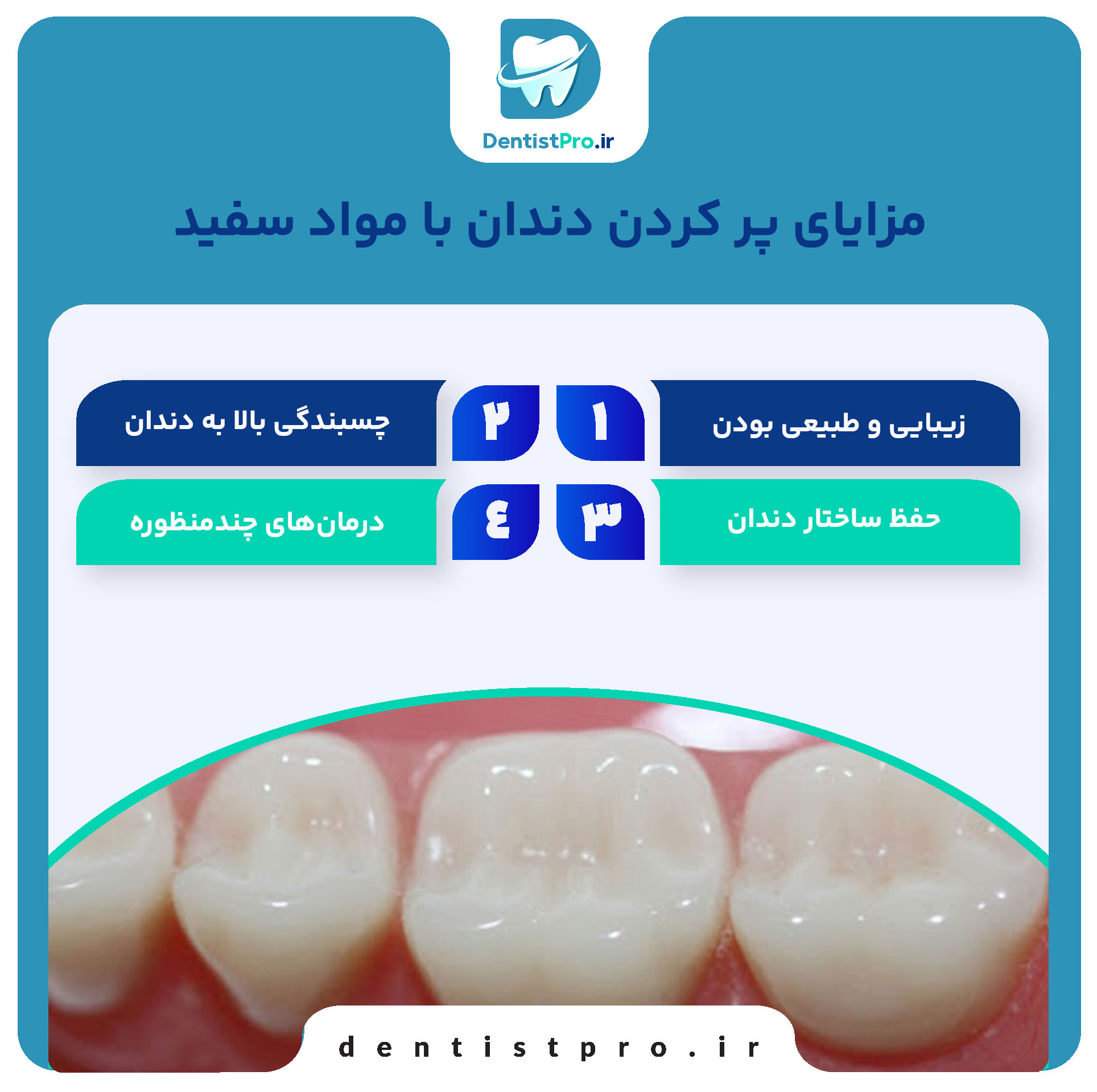 پر کردن دندان با مواد سفید