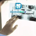 اندودنتیکس سه بعدی با تصویربرداری CBCT: تحولی در درمان ریشه دندان