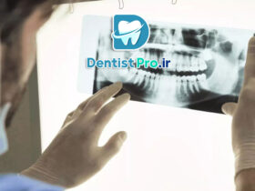 اندودنتیکس سه بعدی با تصویربرداری CBCT: تحولی در درمان ریشه دندان