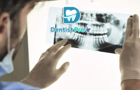 اندودنتیکس سه بعدی با تصویربرداری CBCT: تحولی در درمان ریشه دندان