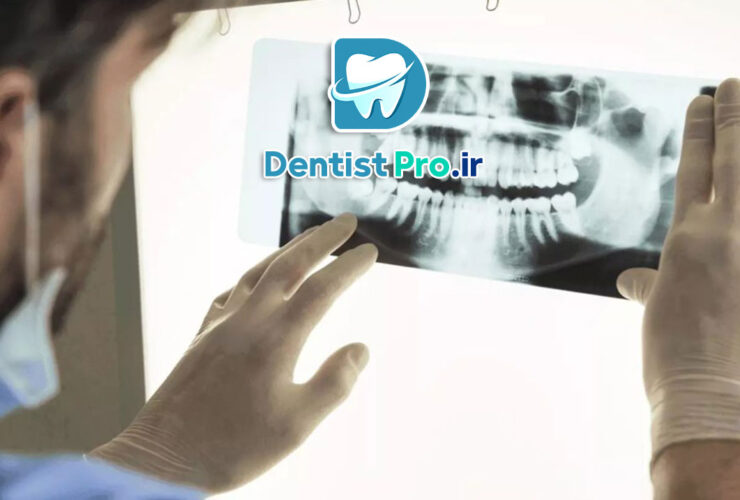 اندودنتیکس سه بعدی با تصویربرداری CBCT: تحولی در درمان ریشه دندان 31 اندودنتیکس سه بعدی با تصویربرداری CBCT: تحولی در درمان ریشه دندان