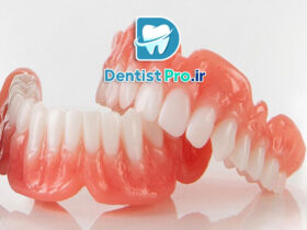 پرینت سه بعدی پروتزهای زیست سازگار با مواد نانوکامپوزیت 29 پرینت سه بعدی پروتزهای زیست سازگار با مواد نانوکامپوزیت