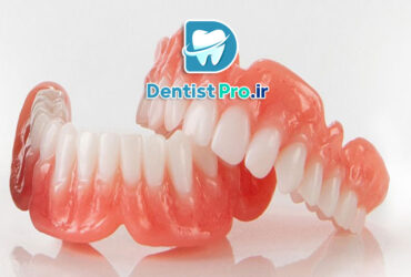 پرینت سه بعدی پروتزهای زیست سازگار با مواد نانوکامپوزیت