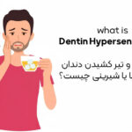دلیل درد و تیر کشیدن دندان در اثر سرما یا شیرینی چیست؟