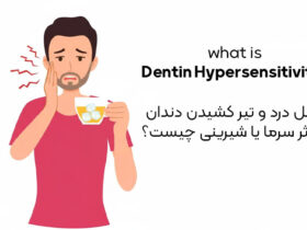 دلیل درد و تیر کشیدن دندان در اثر سرما یا شیرینی چیست؟