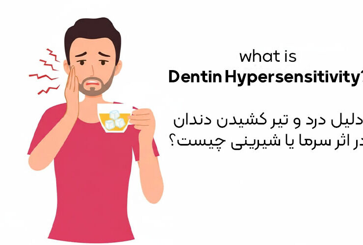 دلیل درد و تیر کشیدن دندان در اثر سرما یا شیرینی چیست؟ 27 دلیل درد و تیر کشیدن دندان در اثر سرما یا شیرینی چیست؟