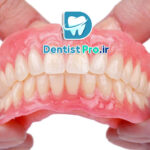 پروتزهای متحرک زیبایی+ موارد 100% مهم