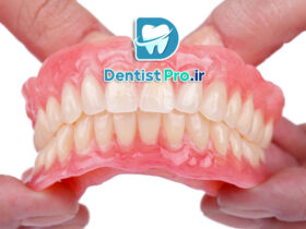 پروتزهای متحرک زیبایی+ موارد 100% مهم