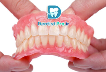 پروتزهای متحرک زیبایی+ موارد 100% مهم