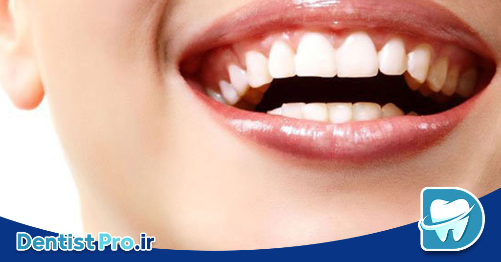 پروتزهای متحرک زیبایی+ موارد 100% مهم 26 پروتزهای متحرک زیبایی+ موارد 100% مهم