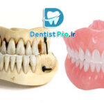 بازسازی آناتومیک دندان ها+ 5 مرحله که باید بدانید