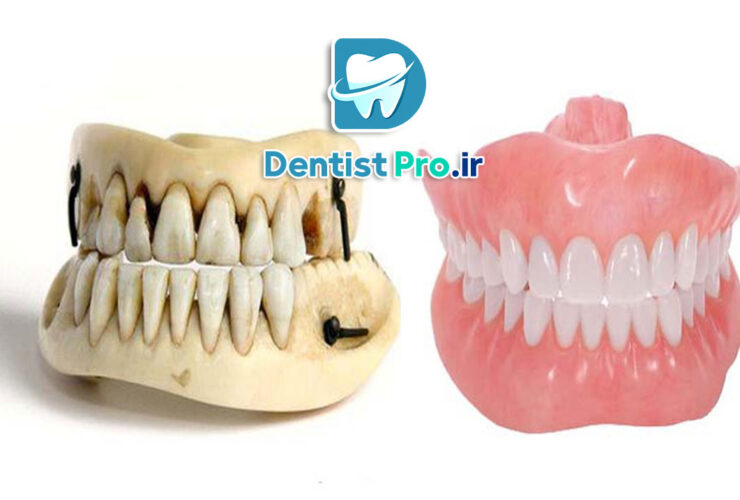 بازسازی آناتومیک دندان ها+ 5 مرحله که باید بدانید