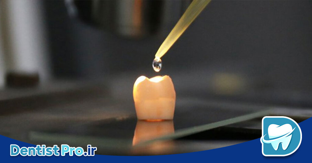 بازسازی آناتومیک مینای دندان: هنر حفظ و بازگردانی ساختار طبیعی دندان 26 بازسازی آناتومیک مینای دندان: هنر حفظ و بازگردانی ساختار طبیعی دندان