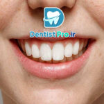 بازسازی آناتومیک مینای دندان: هنر حفظ و بازگردانی ساختار طبیعی دندان