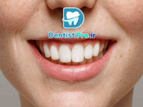 بازسازی آناتومیک مینای دندان: هنر حفظ و بازگردانی ساختار طبیعی دندان