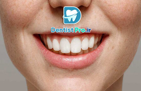 بازسازی آناتومیک مینای دندان: هنر حفظ و بازگردانی ساختار طبیعی دندان