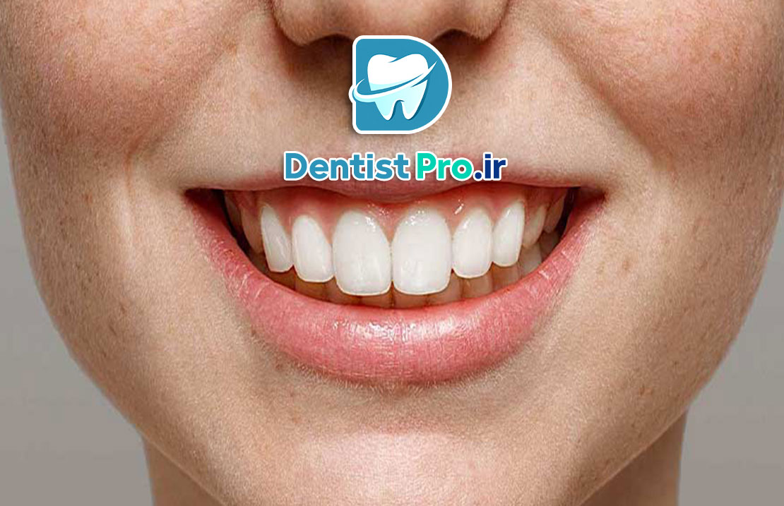 بازسازی آناتومیک مینای دندان: هنر حفظ و بازگردانی ساختار طبیعی دندان 25 بازسازی آناتومیک مینای دندان: هنر حفظ و بازگردانی ساختار طبیعی دندان