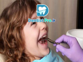 کنترل رفتاری کودکان با تکنیک های روانشناسی دندانپزشکی: کلید موفقیت در درمان‌های دندانپزشکی کودکان