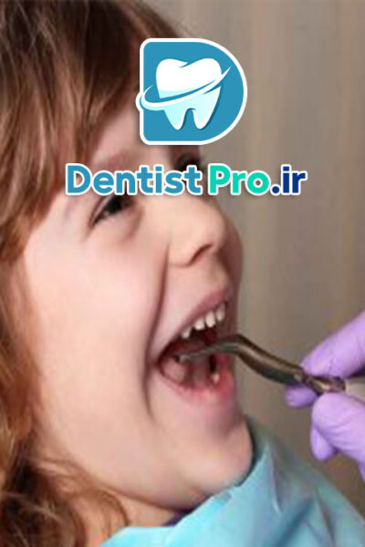 کنترل رفتاری کودکان با تکنیک های روانشناسی دندانپزشکی: کلید موفقیت در درمان‌های دندانپزشکی کودکان