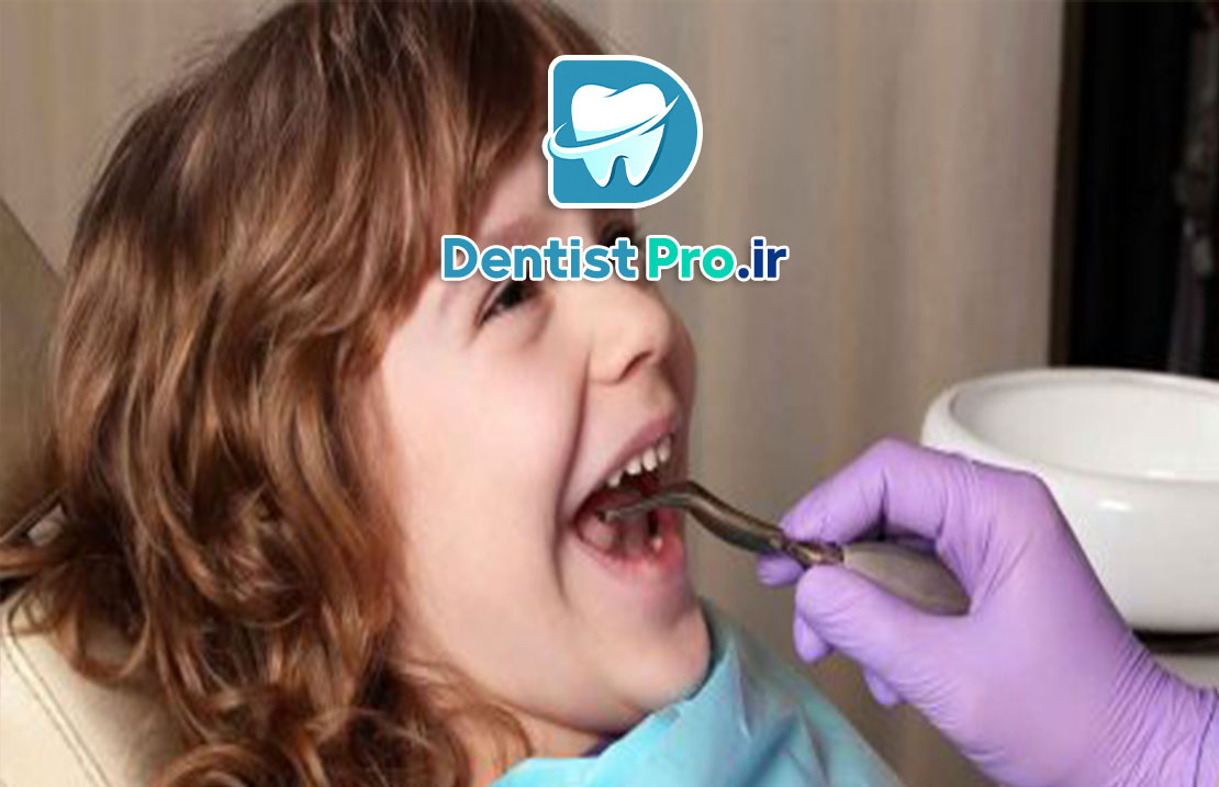 کنترل رفتاری کودکان با تکنیک های روانشناسی دندانپزشکی: کلید موفقیت در درمانهای دندانپزشکی کودکان 25 کنترل رفتاری کودکان با تکنیک های روانشناسی دندانپزشکی: کلید موفقیت در درمانهای دندانپزشکی کودکان