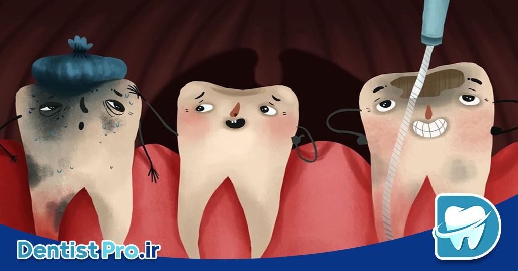 پرکردن کانال با گوتا پرکا حرارتی و مهر و موم سه بعدی: تکنیکی پیشرفته در اندودنتیکس 26 پرکردن کانال با گوتا پرکا حرارتی و مهر و موم سه بعدی: تکنیکی پیشرفته در اندودنتیکس