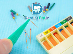 پرکردن کانال با گوتا پرکا حرارتی و مهر و موم سه بعدی: تکنیکی پیشرفته در اندودنتیکس 34 پرکردن کانال با گوتا پرکا حرارتی و مهر و موم سه بعدی: تکنیکی پیشرفته در اندودنتیکس