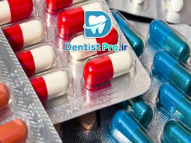 آنتی بیوتیک موضعی کنترل شده در درمان ریشه