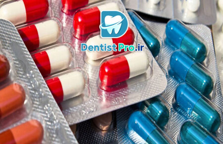 آنتی بیوتیک موضعی کنترل شده در درمان ریشه